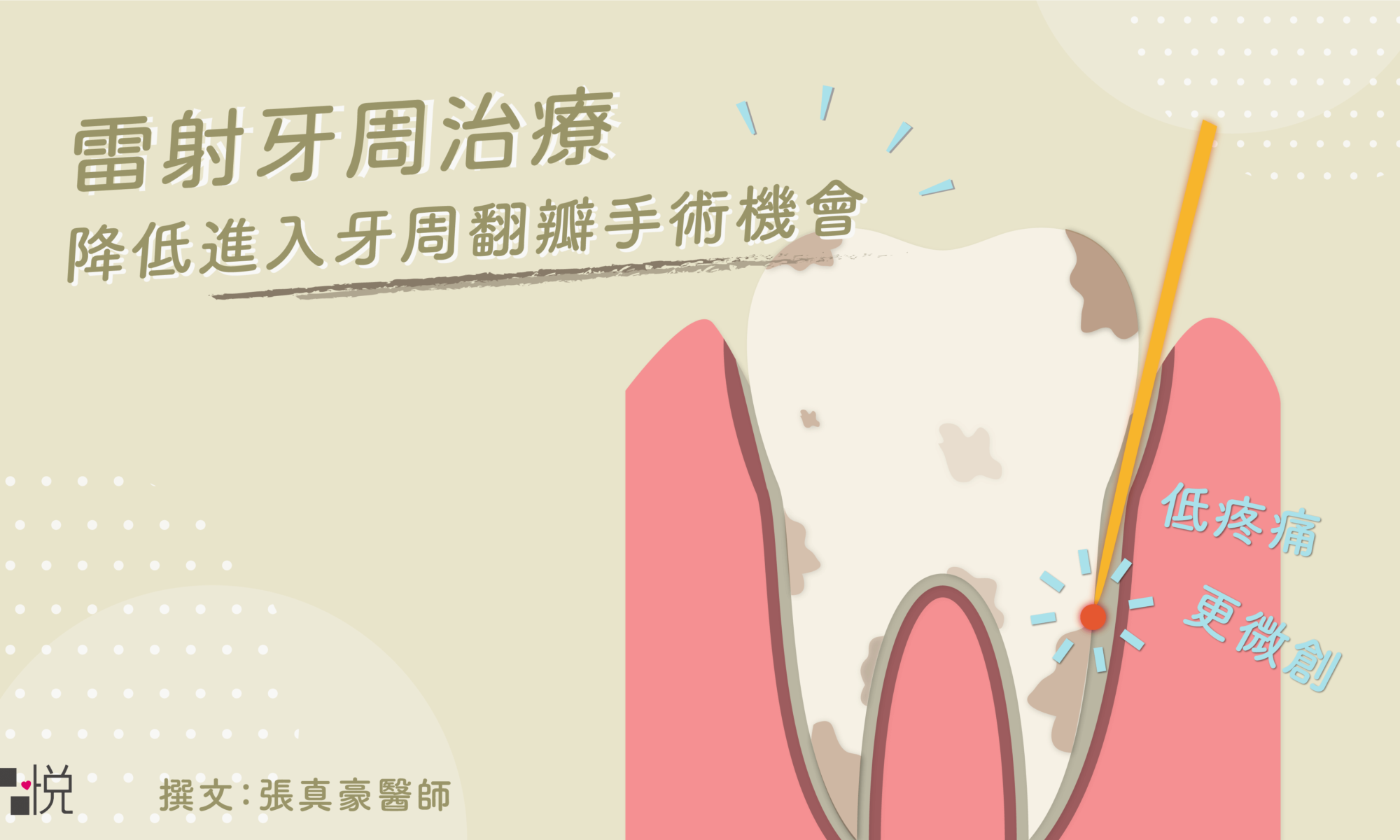 低疼痛的牙周病治療方式