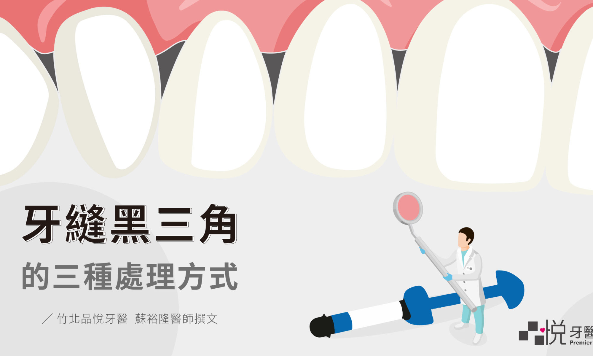 牙縫黑三角的三種牙科處理方式