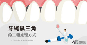 牙縫黑三角的三種牙科處理方式