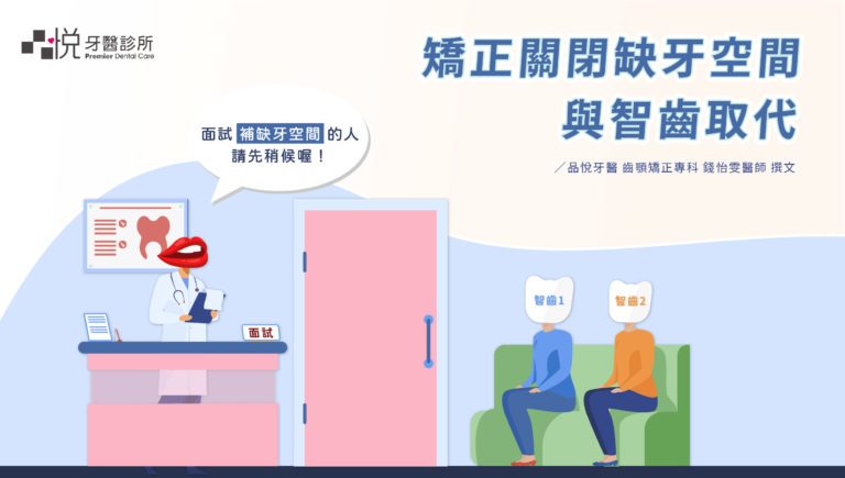 兩顆智齒排隊面試補缺牙