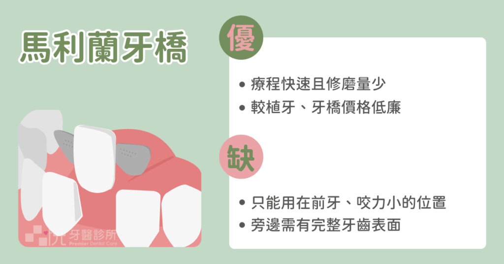 馬利蘭牙橋修磨量少且快速，但是只能使用在前牙或承受咬合力小的部位。