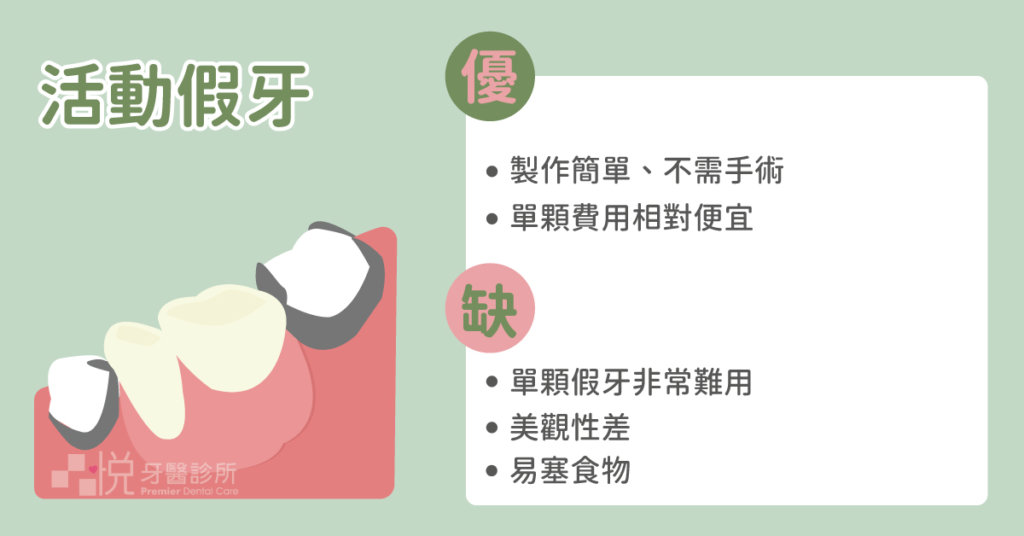 活動假牙製作簡單快速且不需手術，但是尤其單顆假牙非常難用，不僅咬合承受力差、食物容易卡牙縫，還有脫落、噴出的風險。