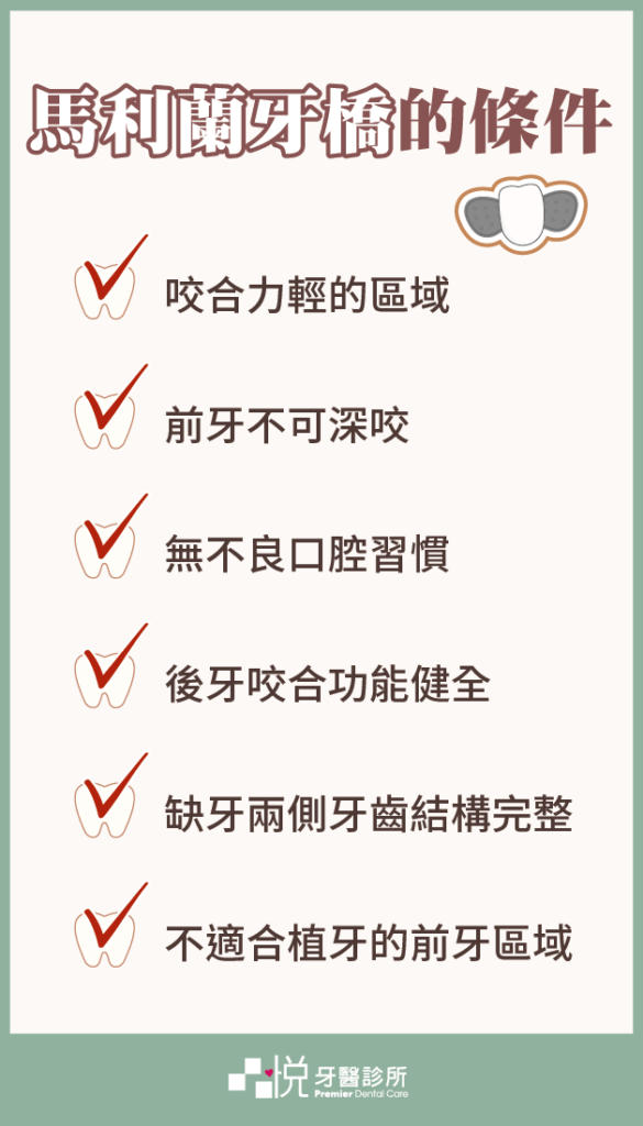 黏著式牙橋（馬利蘭牙橋）的條件：咬合力清、不可深咬、無不良口腔習慣、後牙咬合功能健全、不適合植牙的前牙區域