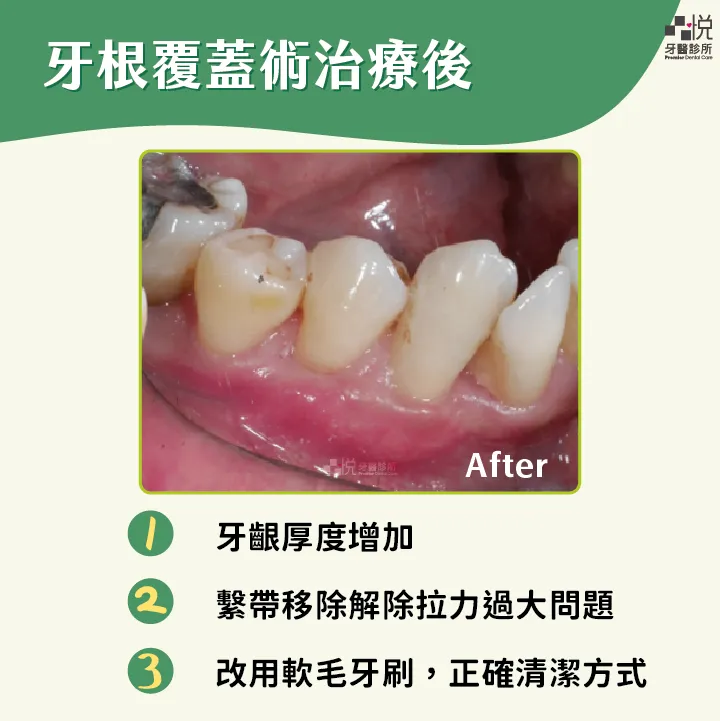 案例分享：張真豪醫師 品悅牙醫